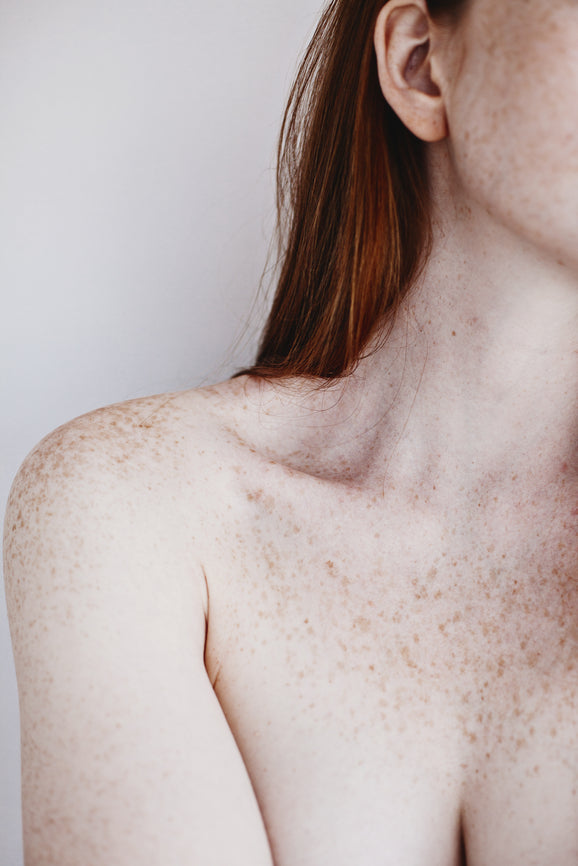 Periorale Dermatitis –  Stress für Dich und Deine Haut